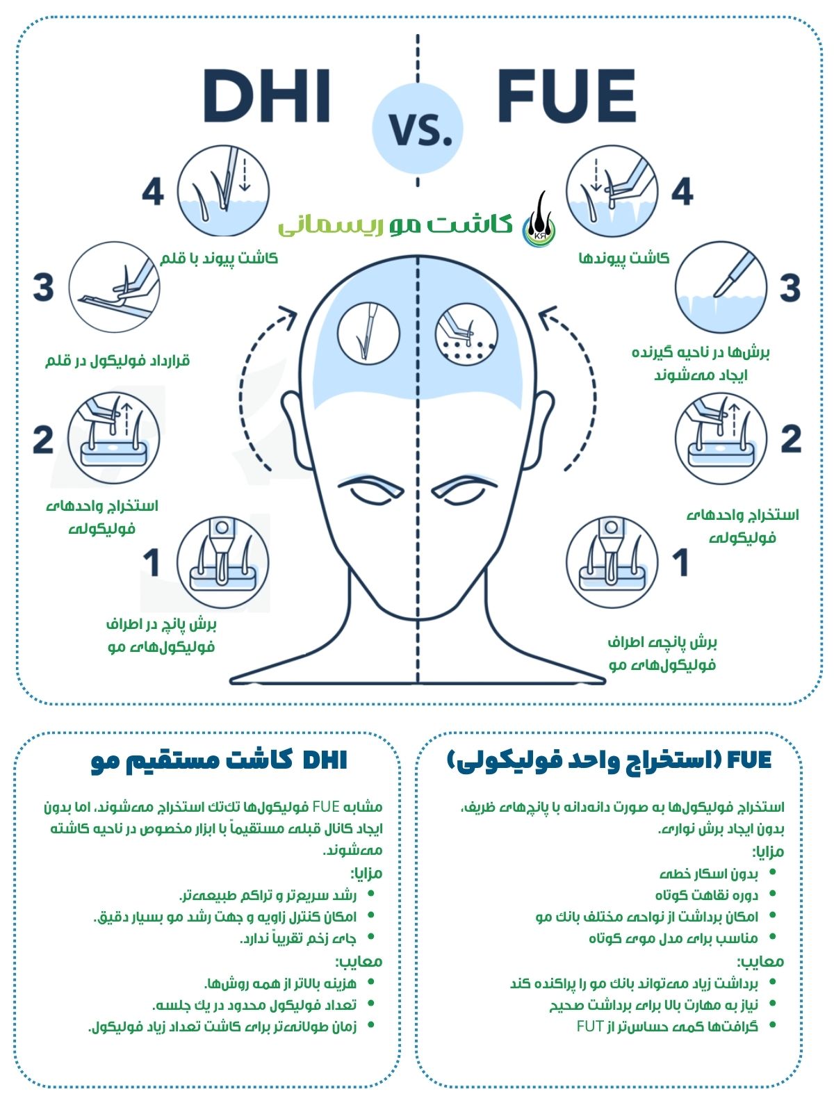 اینفوگرافیک مقایسه کاشت به روش DHI vs FUE اینفوگرافیک مقایسه کاشت به روش DHI vs FUE