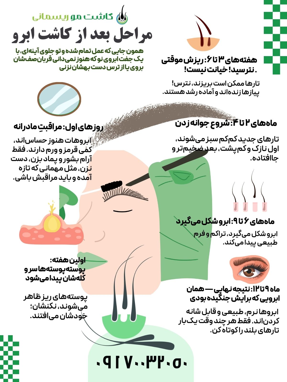 اینفوگرافیک مراحل کاشت ابرو در کلینیک ریسمانی