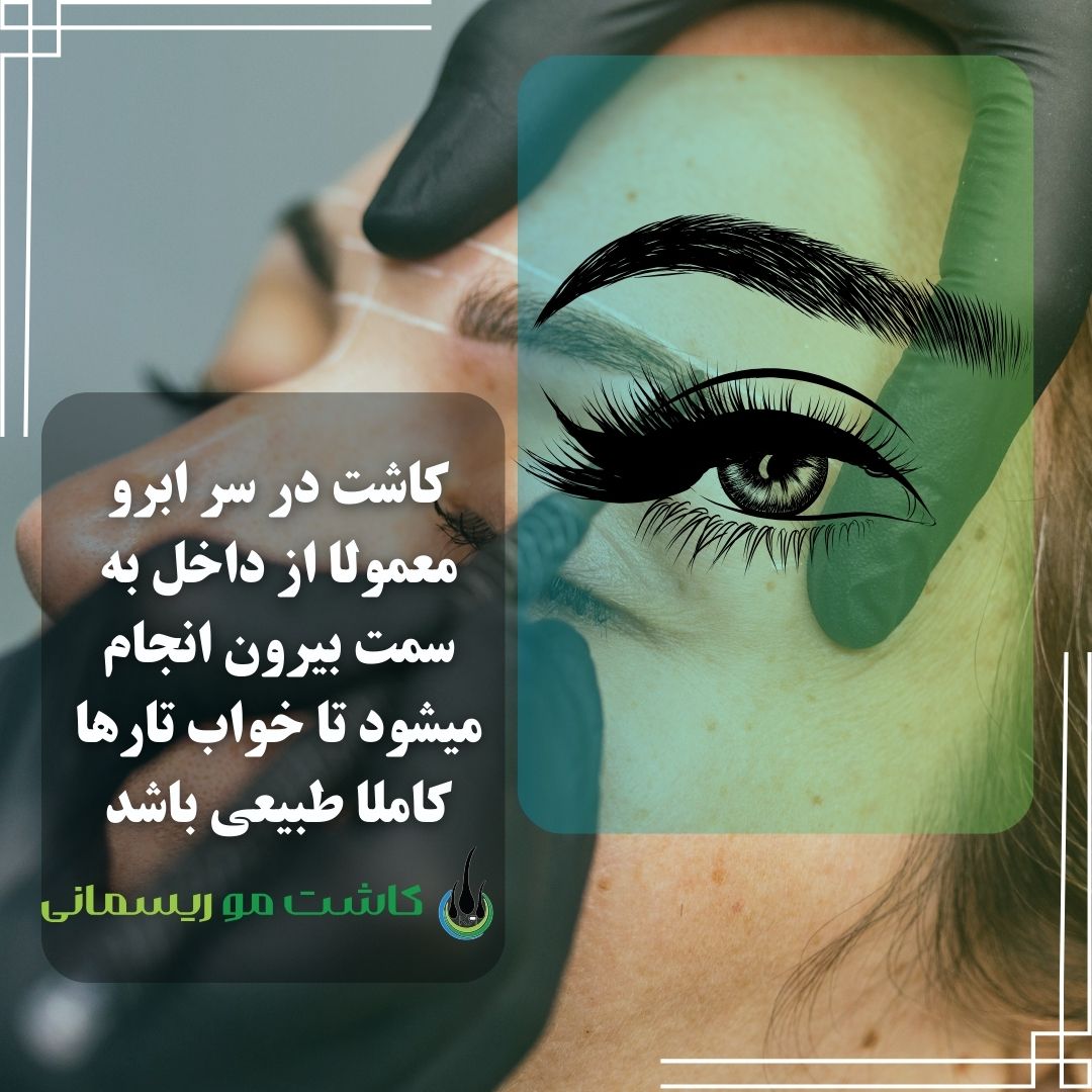 خواب موها در کاشت ابرو