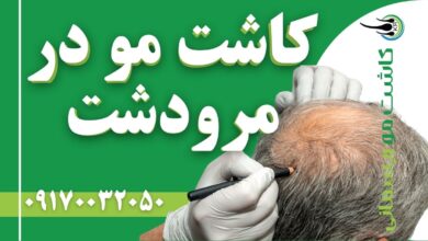کاشت مو در مرودشت