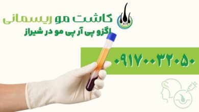 اگزو پی آر پی مو در شیراز