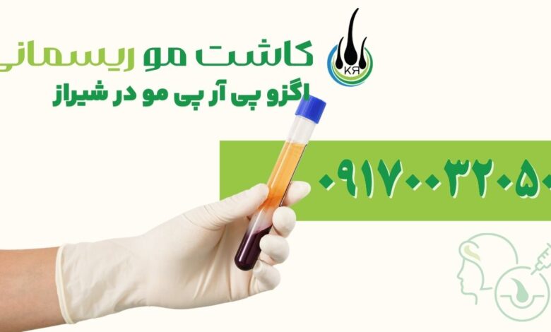 اگزو پی آر پی مو در شیراز