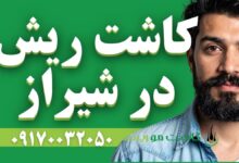 کاشت ریش در شیراز