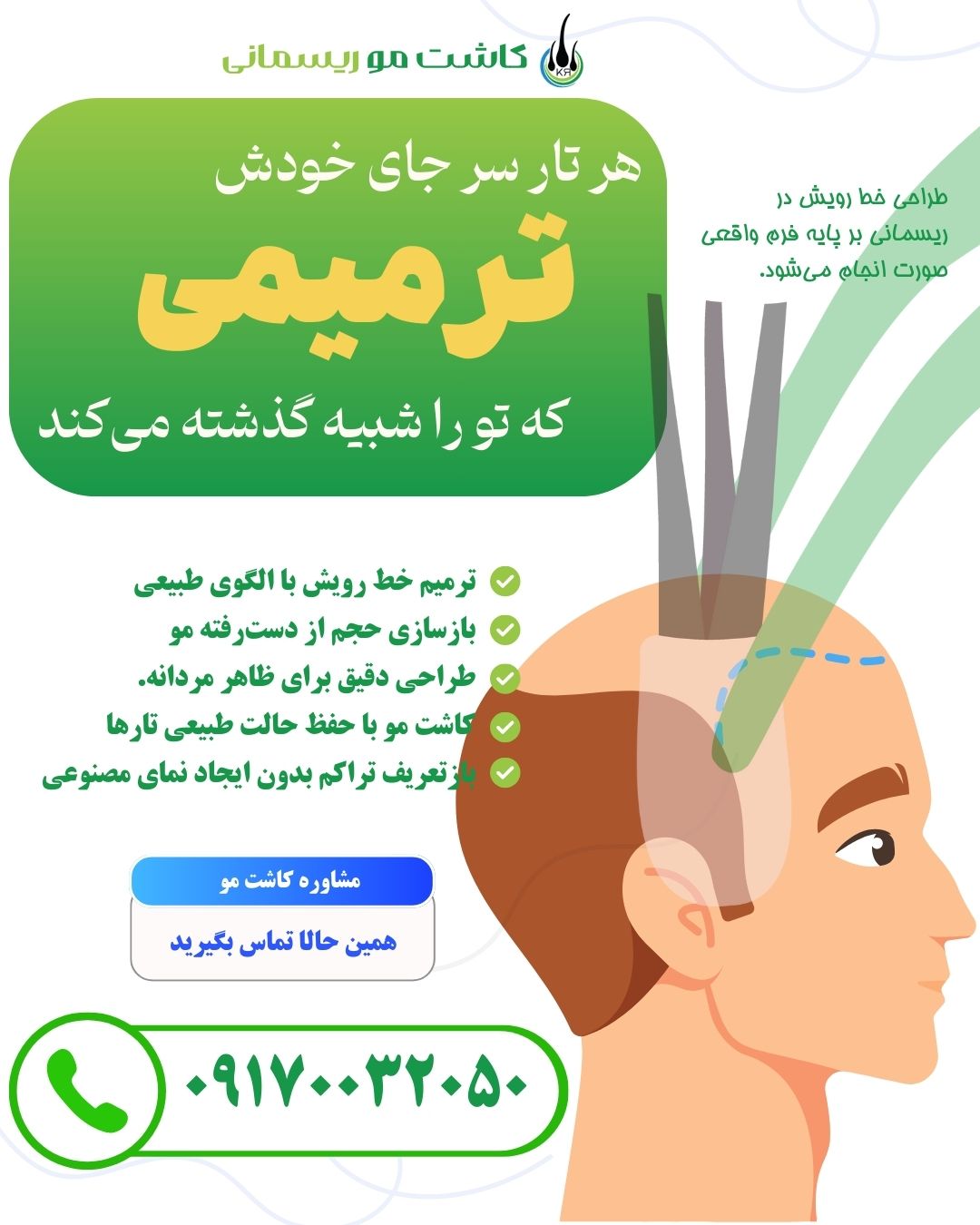 کاشت مو مردان در شیراز کاشت مو مردان در شیراز